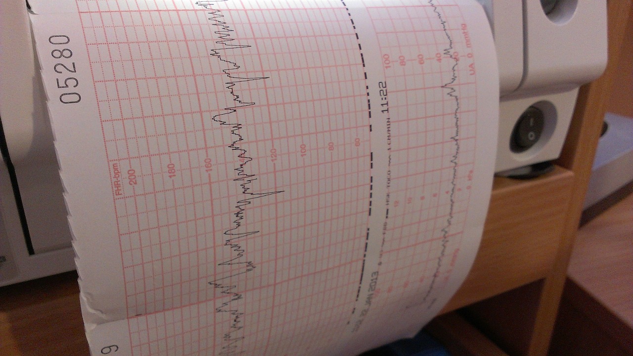 Examen doppler Imagerie medicale